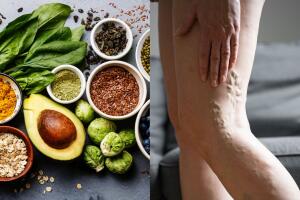 alimentos trombosis circulación