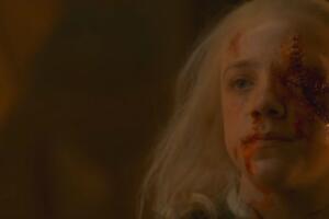 Aemond Targaryen pierde el ojo House of the Dragon.jpg