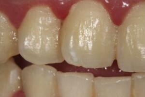 gestante-no-dentista-2.jpg