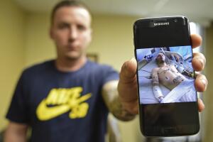 salud opiodes epidemia