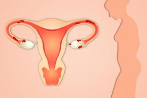 colica-menstrual-0716-630x350-2.jpg