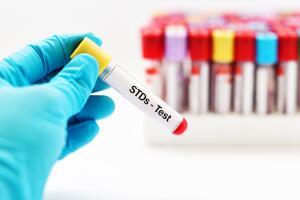 STDs Test