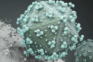 exame-de-hiv-1.jpg