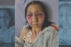 Una anciana sufre una golpiza en Los Angeles.