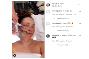 thalia-tratamiento-estetico-filtros-criticas.png