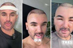 Mauricio Mejía día 1, 2 y 3