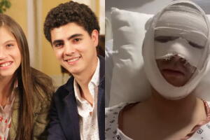 Actor de Mi Corazón Es Tuyo sufre graves quemaduras en el rostro por accidente 
