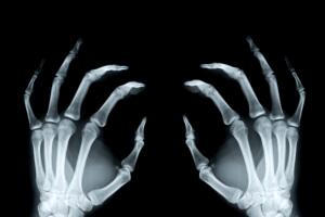 manos-esqueleto.jpg