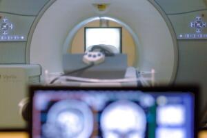 Resonancia magnética MRI