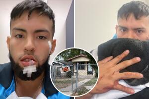 repartidor mordido perro rostro San Antonio Texas