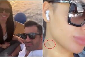 Novia de Toni Costa revela qué son las marcas rojas que aparecen en su cuello
