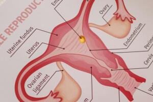 laqueadura-0524-1400x800