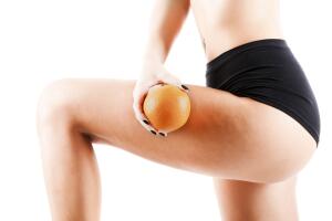 Qué provoca la celulitis y cómo evitarla 