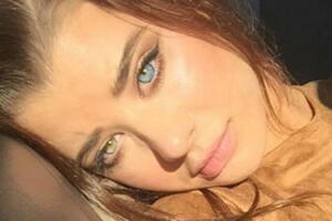 A modelo Sarah McDaniel ganhou destaque por ter olhos de cores diferentes