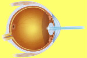 caneta-laser-pode-cegar-2.jpg