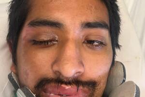 Un tatuaje ayudó a identificar a mexicano con lesión cerebral tras ser atropellado en Arizona