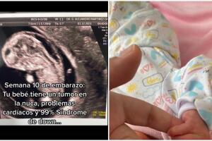Bebê nasce saudável contrariando todos os prognósticos médicos