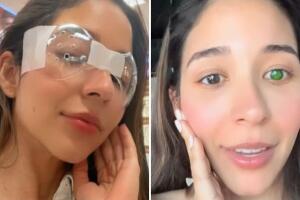 tiktok_ojo_color_verde_cirugia