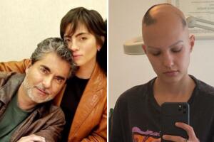 Novia de Camila Araiza, hija de Raúl Araiza, inicia tratamiento contra la alopecia: “A ver qué pasa”
