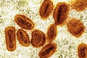 Scientists Charged Mpox