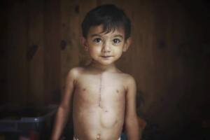 salud obamacare beneficiarios fallas