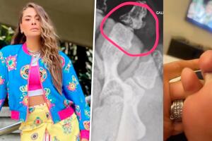 Galilea Montijo sufre accidente y termina con fractura: esto fue lo que pasó 