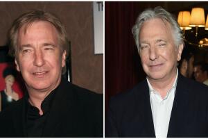 Alan Rickman antes y después univision.jpg