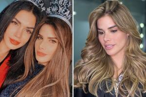 marie claire harp fotos antes y despues cirugias.jpg