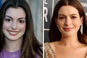 anne-hathaway-antes-después.jpg