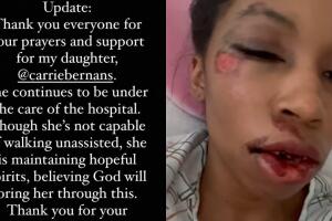 La mamá de Carrie Bernans confirmó que su hija no puede caminar aún sin ayuda a consecuencia de las lesiones que tiene en la pelvis.
