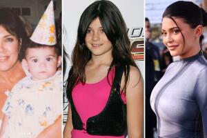 kylie-jenner-fotos-antes-despues.jpg