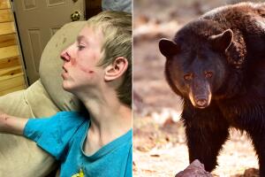 Adolescente se recupera tras el ataque de un oso negro en Arizona