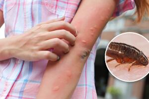 Confirman caso de peste en South Lake Tahoe: síntomas, riesgos y consejos de protección