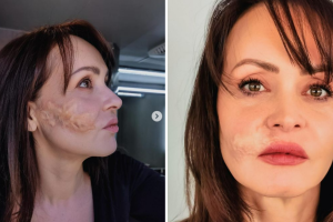 Gaby Spanic usó una cicatriz en 'Corazón guerrero'