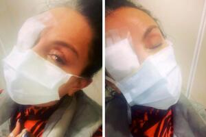 Ivonne Montero apareció así en Instagram tras sufrir un accidente en sus córneas.