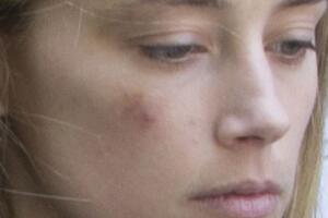 Amber Heard golpeada