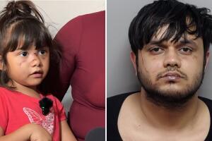 San Antonio niña atacada mordida en el rostro Parque de las Misiones Atharva Vyas asalto a menor lesiones corporales Texas