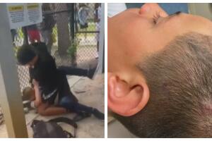 niño de 13 años brutal golpiza escuela Broward