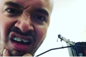 J Balvin sin diente