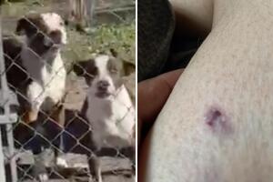 María Rendón mujer atacada perros callejeros San Antonio Texas