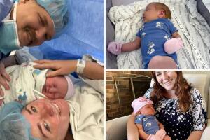 El hospital revisa récords para comparar el caso con otros nacimientos similares en la región.