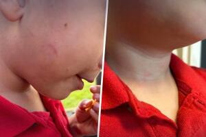 manor isd kid agression ATX