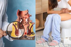 Estreñimiento causas problema