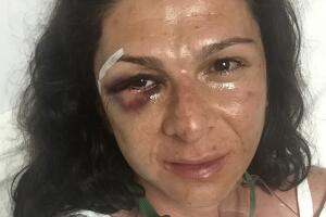 Golpes en la cara de la senadora mexicana Ana Gabriel Guevara