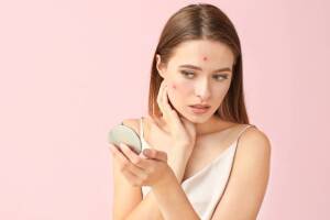 mujer-con_acne-viendose-al-espejo.jpg