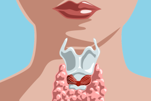 tireoide-mulher-0317-1400x800.png