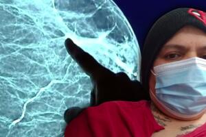 Teresa Ruvalcaba no fue al médico por miedo a contagiarse de covid-19 y ahora sufre un cáncer de seno en fase 4