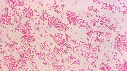bacterias bajo un microscopio
