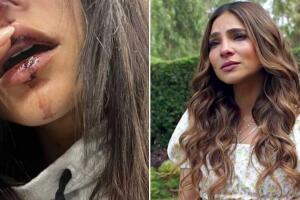 Alejandra Espinoza en Corazón Guerrero: la actriz responde a quienes no creen que fue "real" su accidente