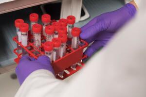 US-HEALTH-PEOPLE-RESEARCH-CANCER-pharmaceutical